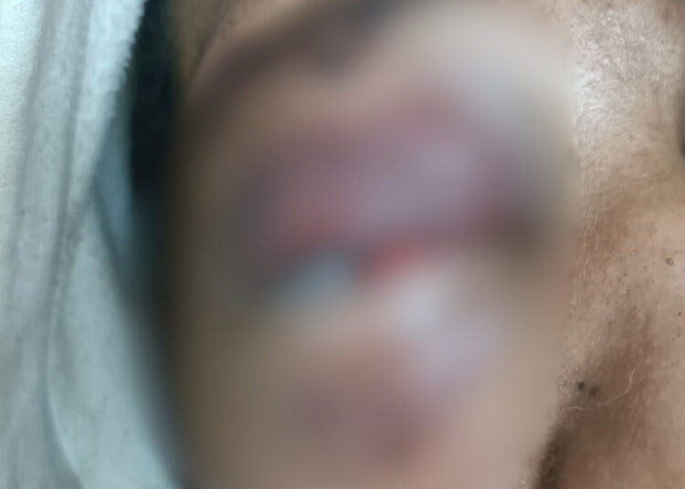 Jovem relata perda de visão após agressão e abandono em ação da GCM em Itapetininga